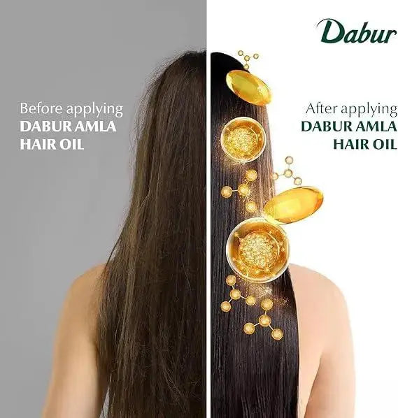 Dabur AMLA Hair Oil 200ml  Adomoo