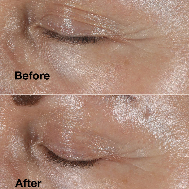 Smart Clinical Repair™ Wrinkle Correcting Eye Cream 15ml