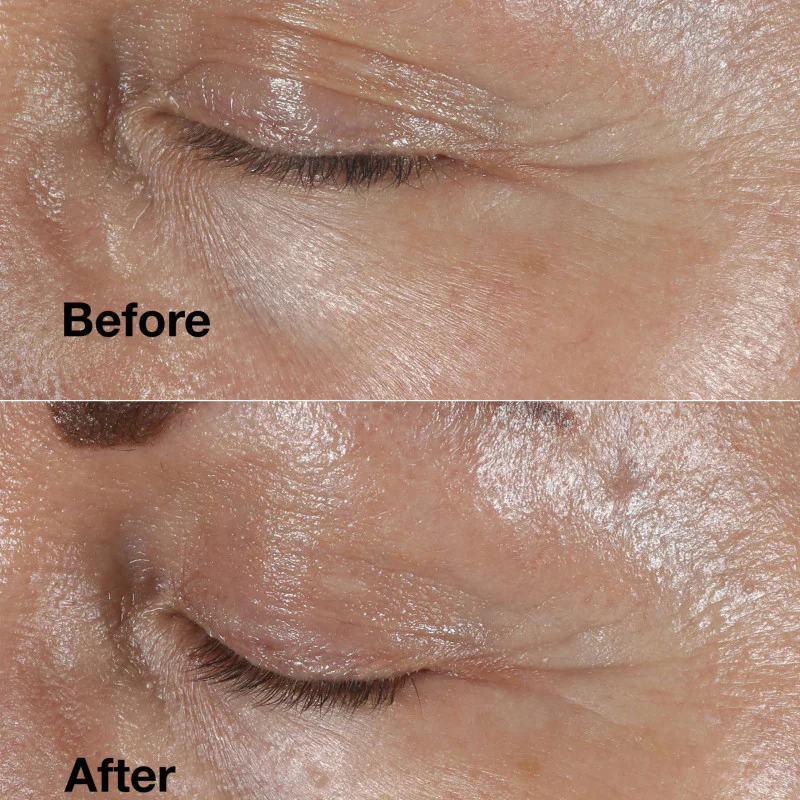 Smart Clinical Repair™ Wrinkle Correcting Eye Cream 15ml